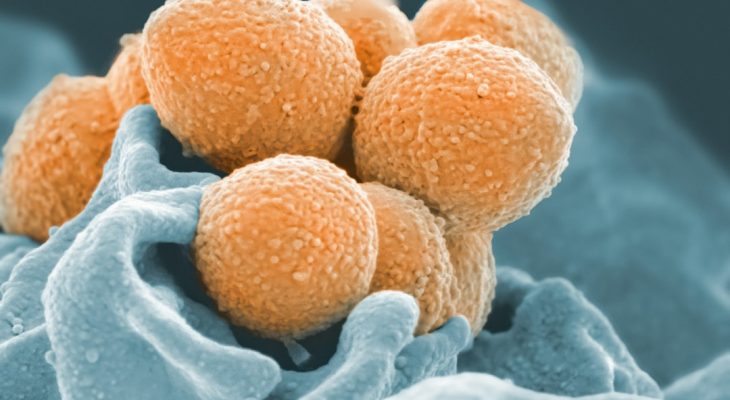 What Does Unicellular Mean and Why It’s Basically a One-Person Party in a Cell